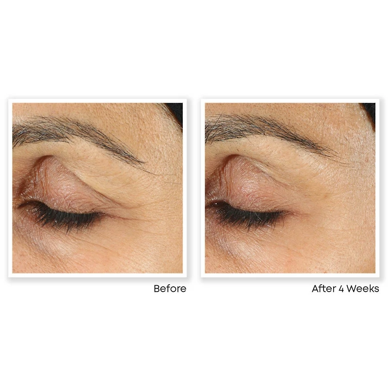 Retinol Correxion Line Smoothing Eye Cream