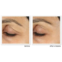 Retinol Correxion Line Smoothing Eye Cream