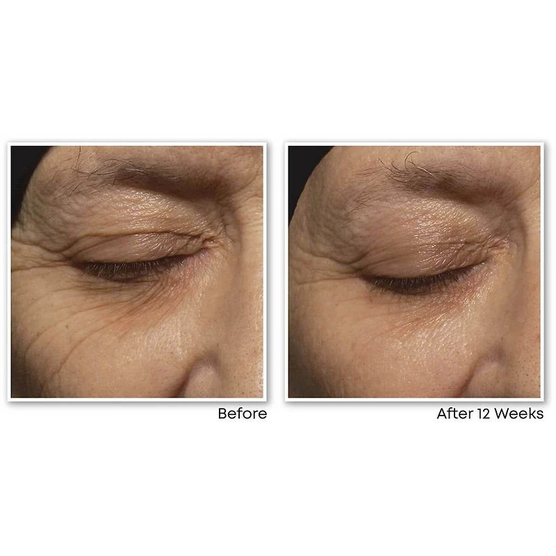 Retinol Correxion Deep Wrinkle Night Cream