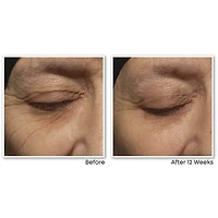 Retinol Correxion Deep Wrinkle Night Cream