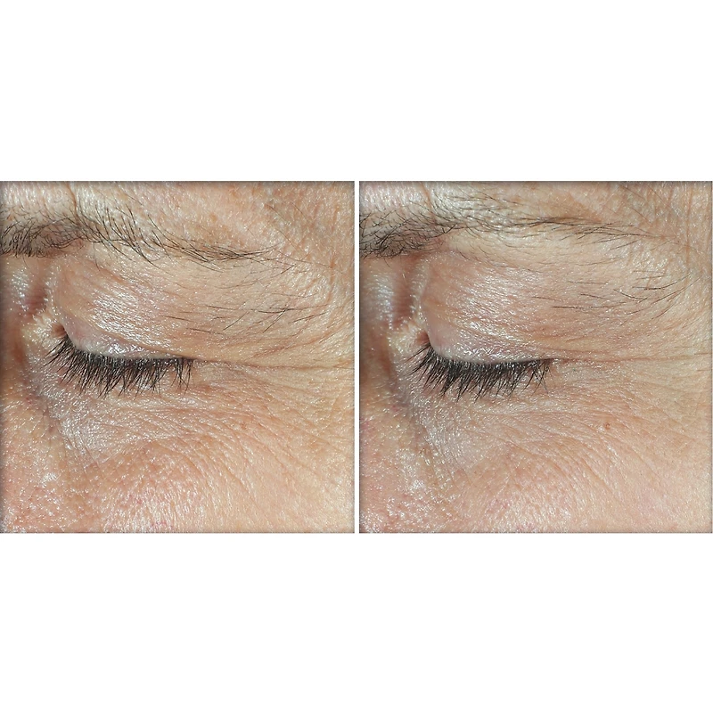 Derm Correxion®️- Dual Eye Cream - Advanced Retinol & Peptide (2x10ml)