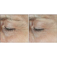 Derm Correxion®️- Dual Eye Cream - Advanced Retinol & Peptide (2x10ml)