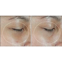 Multi Correxion®️ - Revive + Glow - Eye Balm + Vitamin C