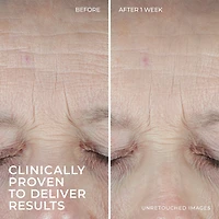 Roc Multi Correxion Hydration Plus Moisturizer 1.7 Oz