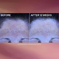 Crème De Nuit À La Vitamine C