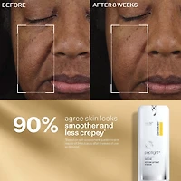 tighten & lift discovery series kit