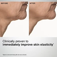TL Advanced™ Sculpting Neck & Jawline Mask