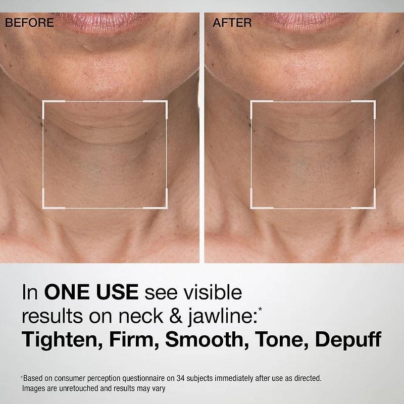 TL Advanced™ Sculpting Neck & Jawline Mask