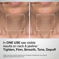 TL Advanced™ Sculpting Neck & Jawline Mask