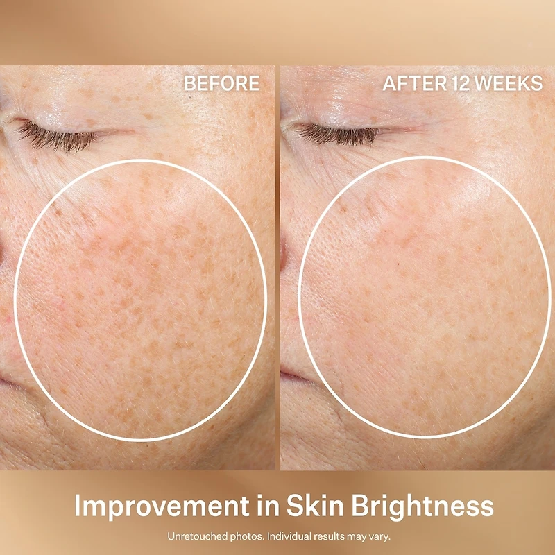 Super-C Retinol Brighten & Correct Vitamin C Serum