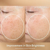 Super-C Retinol Brighten & Correct Vitamin C Serum