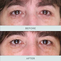 Sérum raffermissant au niacinamide pour les yeux
