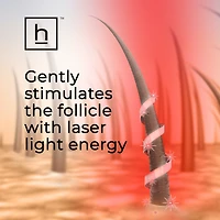 LaserBand 82 ComfortFlex