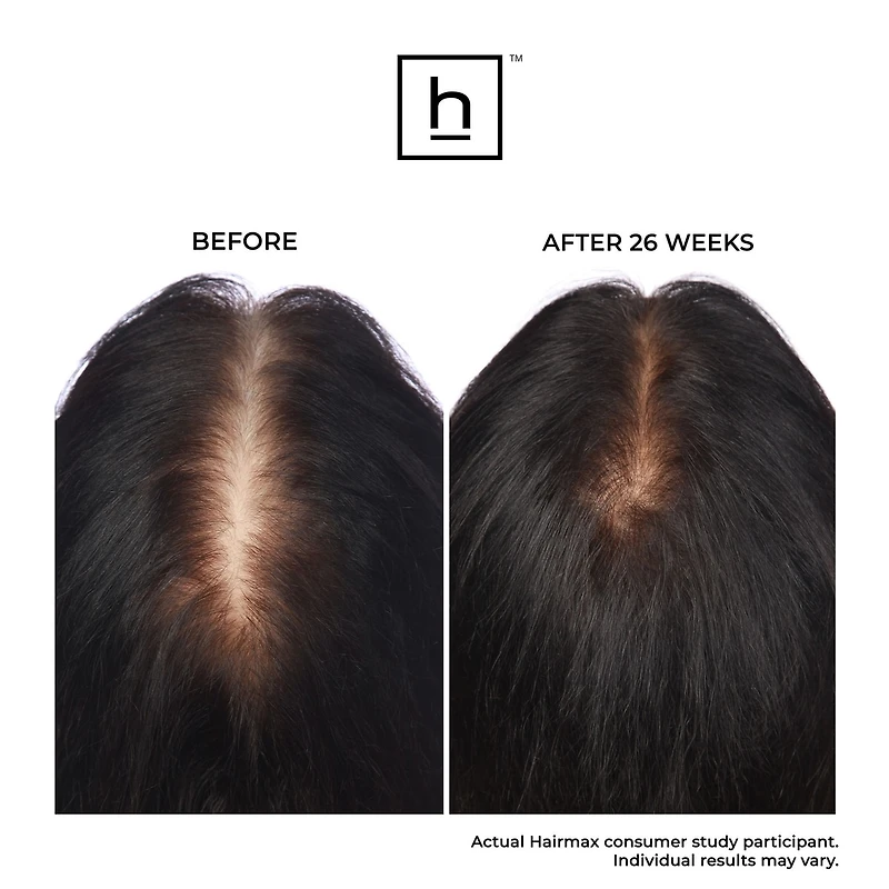 Bande laser 82 ComfortFlex