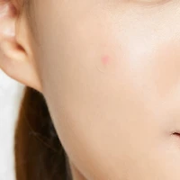 Patches Anti-Imperfections Original Fit 24 Patchs