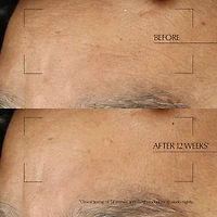 Traitement de nuit Advanced Night Repair