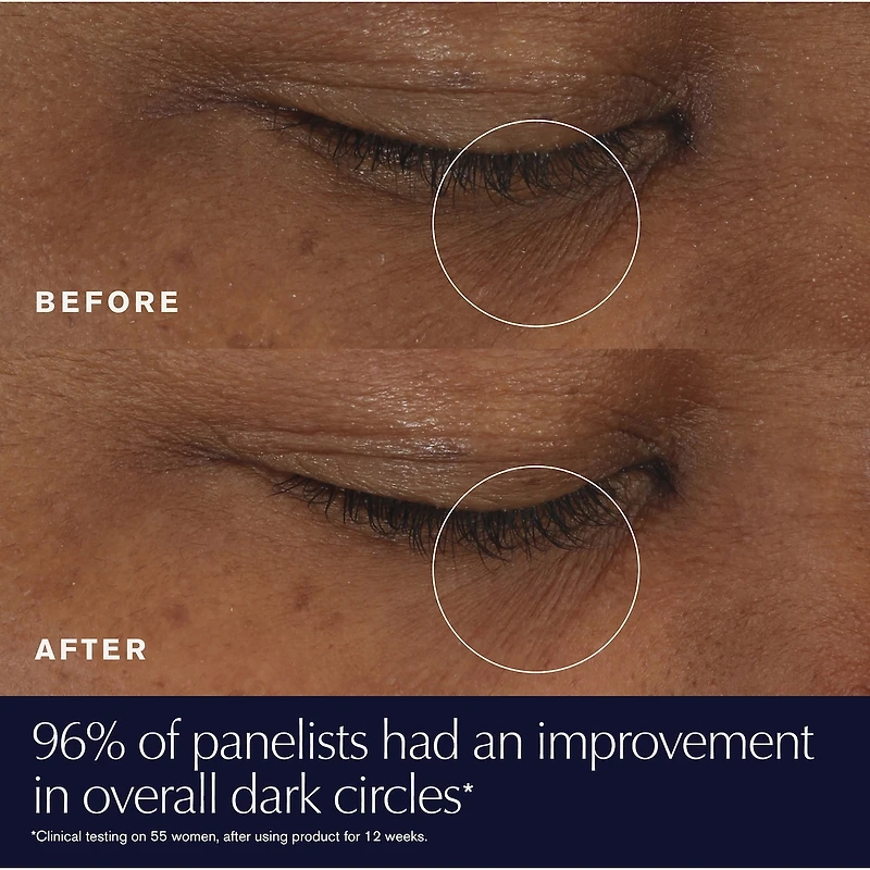 Crème gel-crème contour des yeux Advanced Night Repair Supercharged en édition limitée