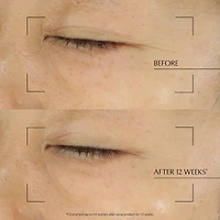 Beauty Must-Haves Set for Face and Eyes