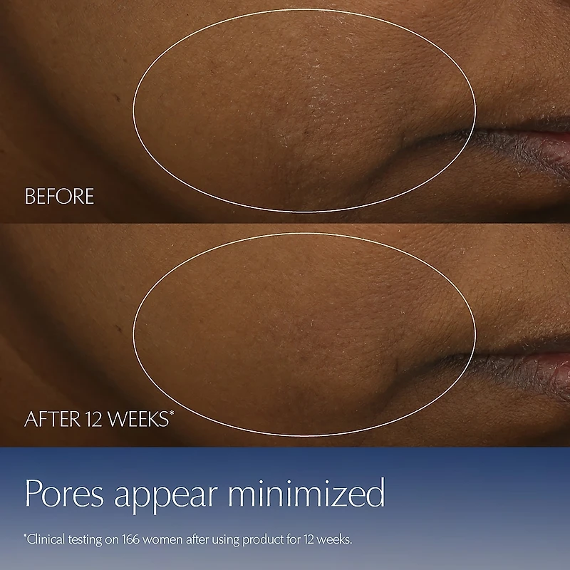 Limited Edition Advanced Night Repair Serum