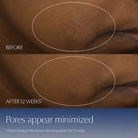 Limited Edition Advanced Night Repair Serum