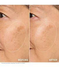 Clarins Bright Plus Advanced Brightening Vitamin C and Niacinamide Dark Spot Serum