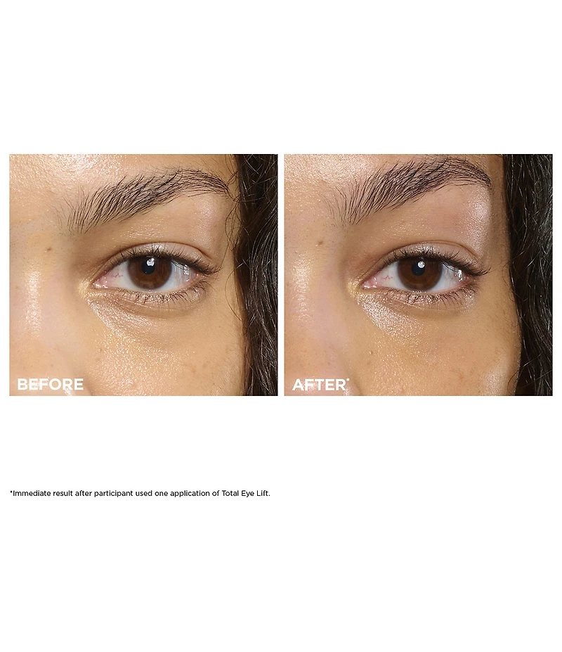 Clarins Total Eye Lift Eye Cream for Firming, Wrinkles