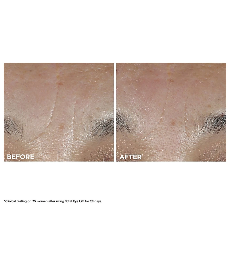Clarins Total Eye Lift Eye Cream for Firming, Wrinkles