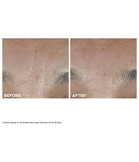 Clarins Total Eye Lift Eye Cream for Firming, Wrinkles