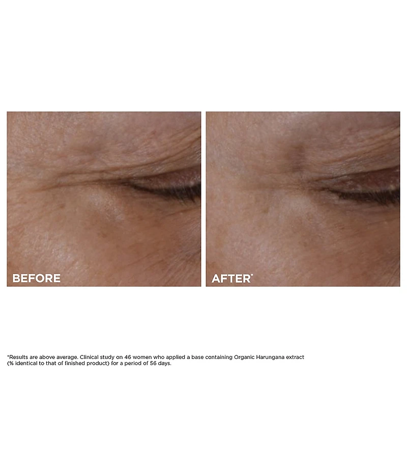 Clarins Total Eye Lift Eye Cream for Firming, Wrinkles