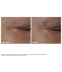 Clarins Total Eye Lift Eye Cream for Firming, Wrinkles