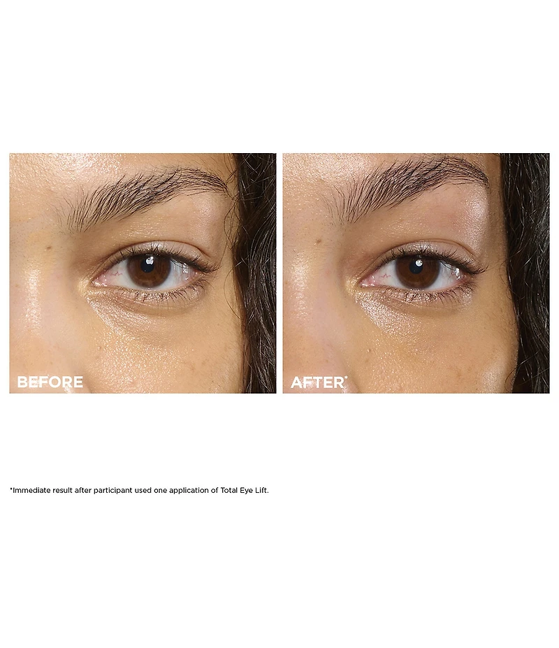 Clarins Total Eye Lift for Firming, Wrinkles, Dark Circles and Puffiness Gift Set