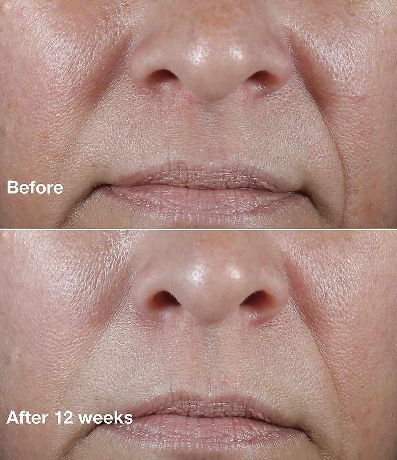 Clinique Smart Clinical Repair Wrinkle Correcting Rich Face Cream oz