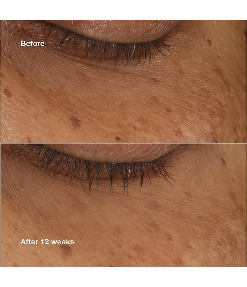Clinique All About Eyes™ Brightening Concentrate Retinoid Serum