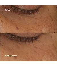 Clinique All About Eyes™ Brightening Concentrate Retinoid Serum
