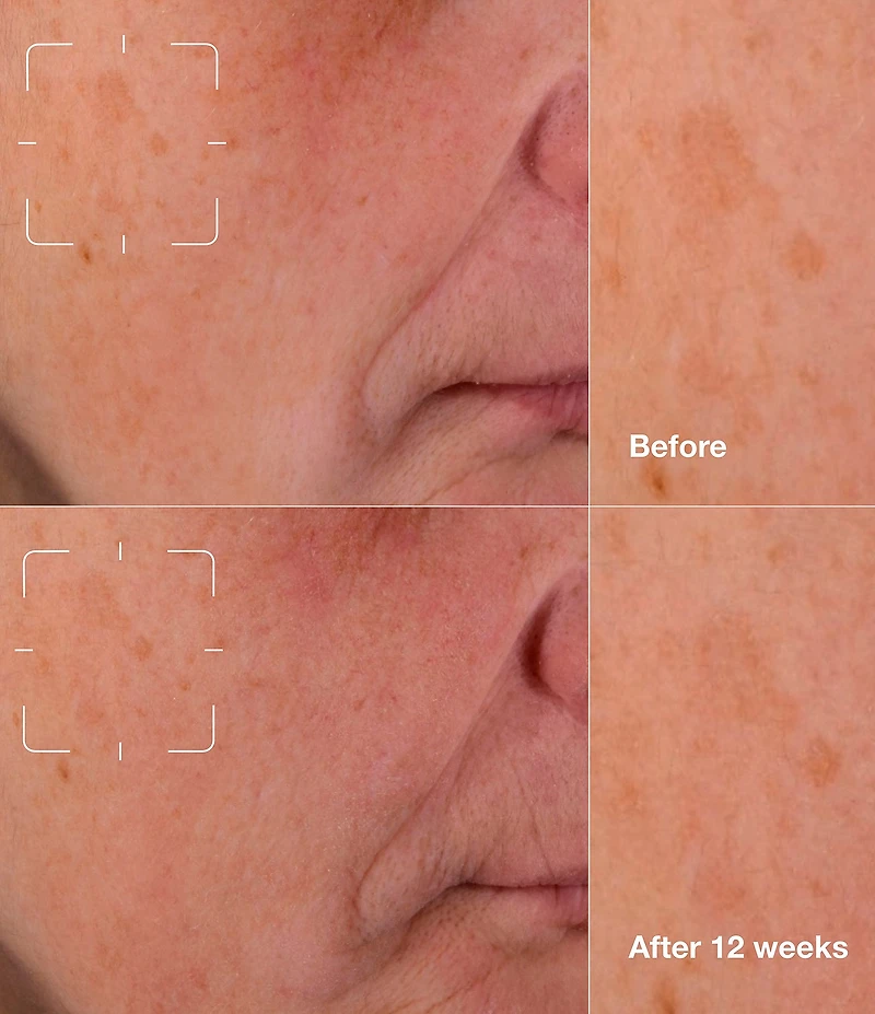 Clinique Brightening Routine: Mini Even Better Skincare Kit