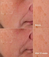 Clinique Brightening Routine: Mini Even Better Skincare Kit