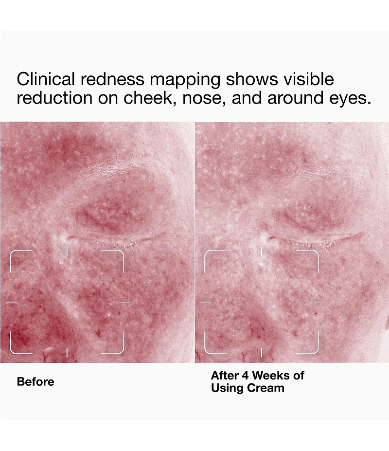 Clinique Daily Calm™ Gentle Cream Face Cleanser