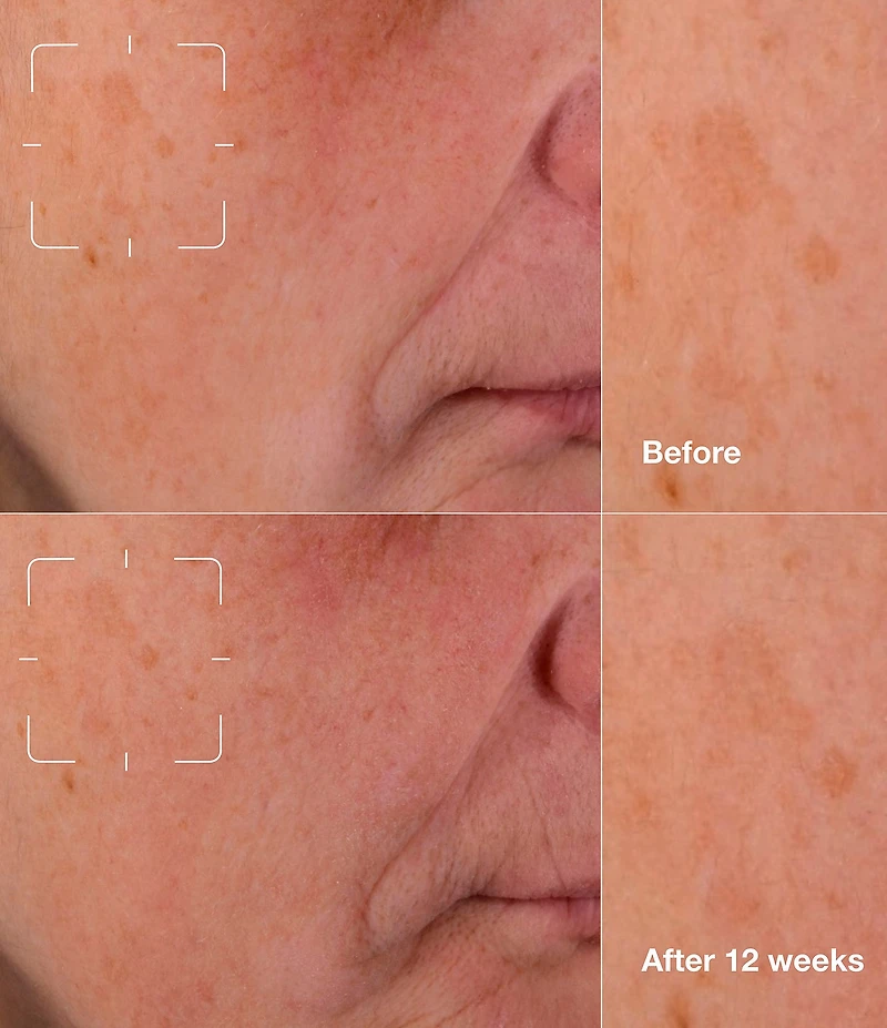 Clinique Even Better Clinical™ Dark Spot Clearing Serum with Vitamin C