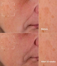 Clinique Even Better Clinical™ Dark Spot Clearing Serum with Vitamin C