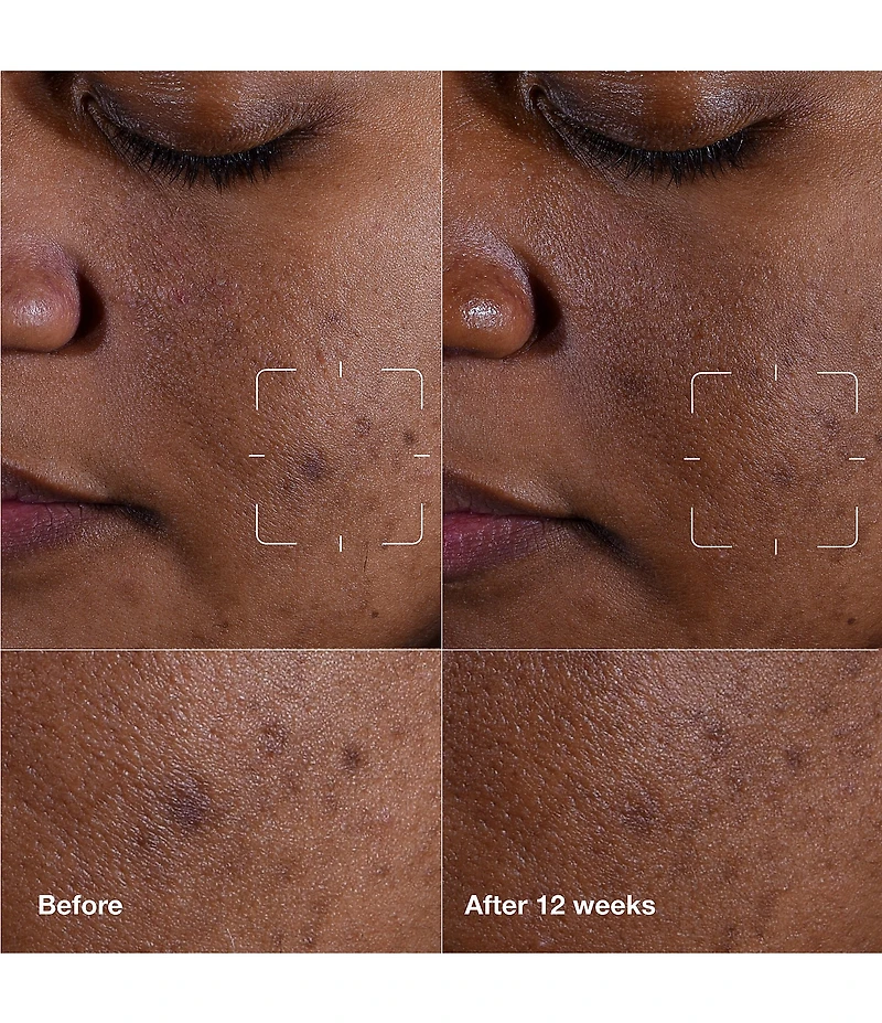 Clinique Even Better Clinical™ Dark Spot Clearing Serum with Vitamin C