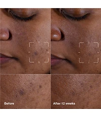 Clinique Even Better Clinical™ Dark Spot Clearing Serum with Vitamin C