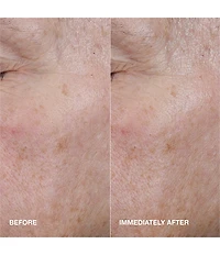 Clinique Moisture Surge™ Active Glow Serum with Hyaluronic Acid