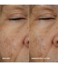 Clinique Moisture Surge™ Active Glow Serum with Hyaluronic Acid