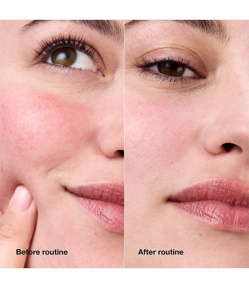 Clinique Redness Relief Skincare Set