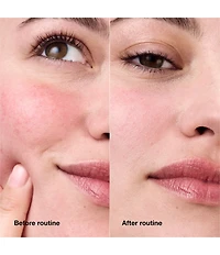 Clinique Redness Relief Skincare Set