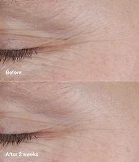 Clinique Smart Clinical Repair™ AM/PM Retinoid Balm