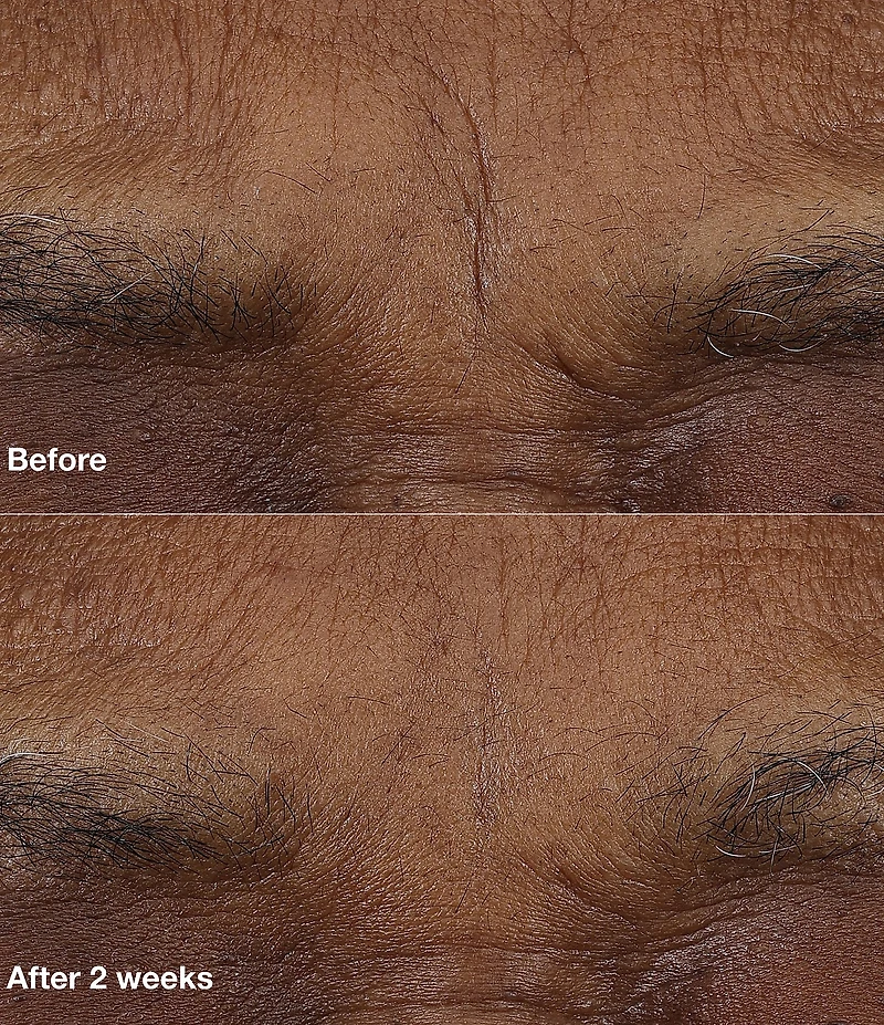 Clinique Smart Clinical Repair™ AM/PM Retinoid Balm