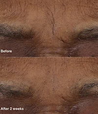 Clinique Smart Clinical Repair™ AM/PM Retinoid Balm