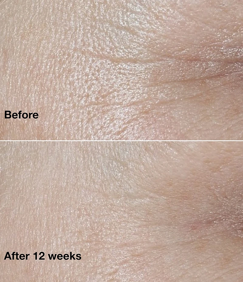 Clinique Smart Clinical Repair™ Wrinkle Correcting Cream