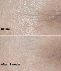Clinique Smart Clinical Repair™ Wrinkle Correcting Cream